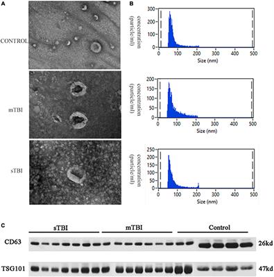 Using bioinformatics technology to mine the expression of serum exosomal miRNA in patients with traumatic brain injury